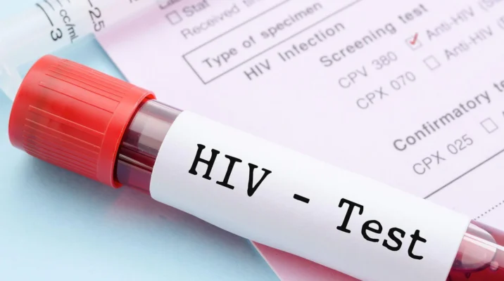 A Comprehensive Guide to HIV and AIDS