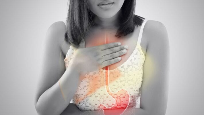 Everything You Need to Know About Acid Reflux and GERD