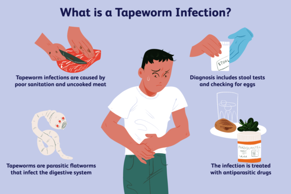 Fish Tapeworm Infection (Diphyllobothriasis)