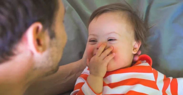 Mosaic Down Syndrome