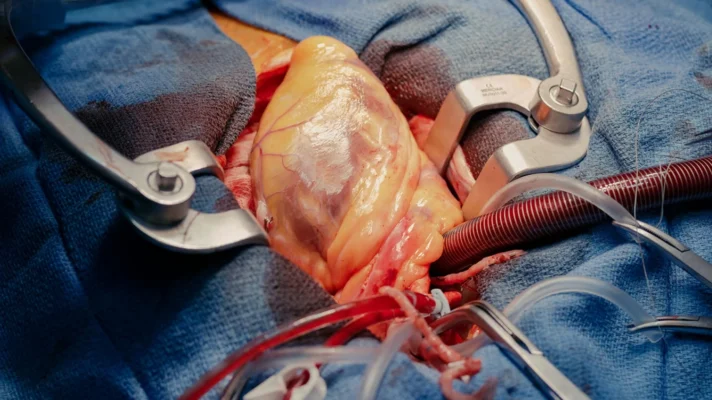 What Is the Difference Between a Heart Bypass and Open-Heart Surgery